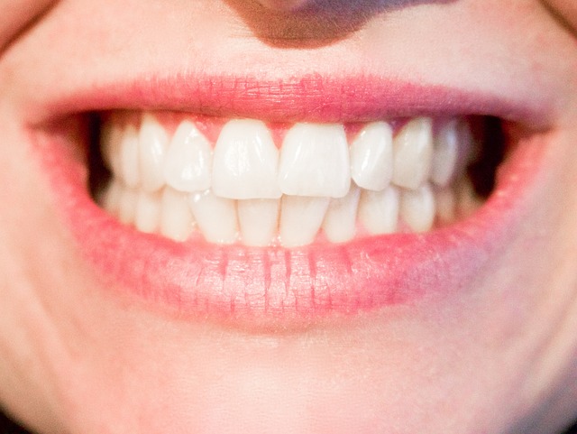 Schöne-Zähne-sind-absolut-individuell